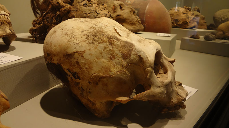 Crânio de formato incomum em exibição em um museu. A parte posterior do crânio é muito mais longa e maior do que em um crânio típico.