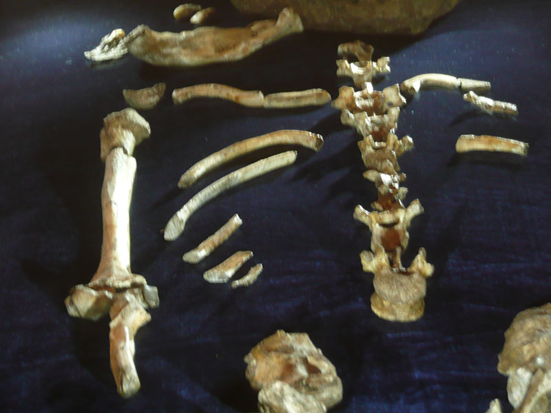 Coleção de ossos, incluindo uma parte de uma coluna vertebral.