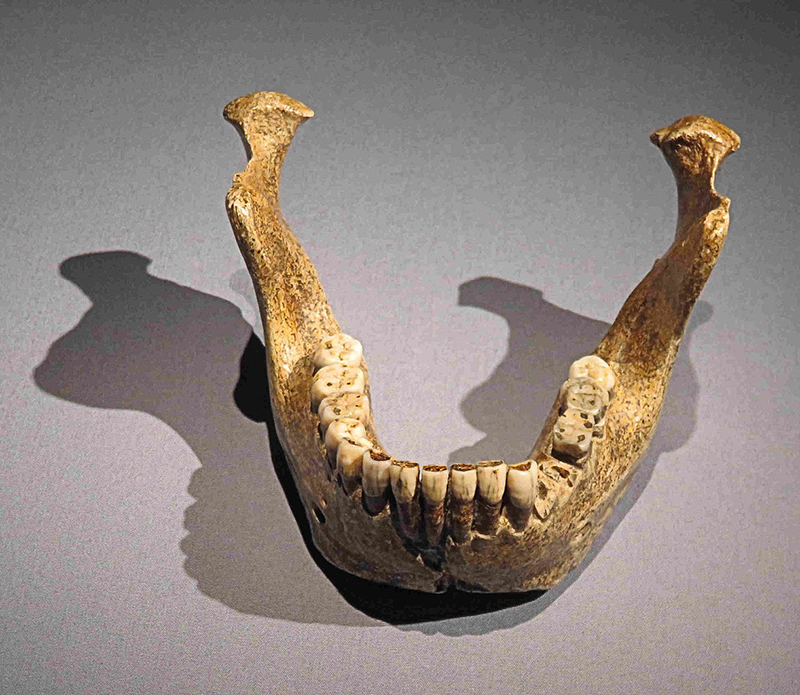 Como séculos de endogamia levaram à distinta 'mandíbula de