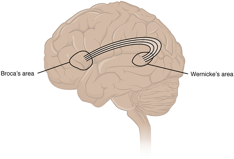 Outline of the human brain with Broca’s area circled, near the front, and Wernicke’s area circled, further back. The two circled areas are connected by a series of line.