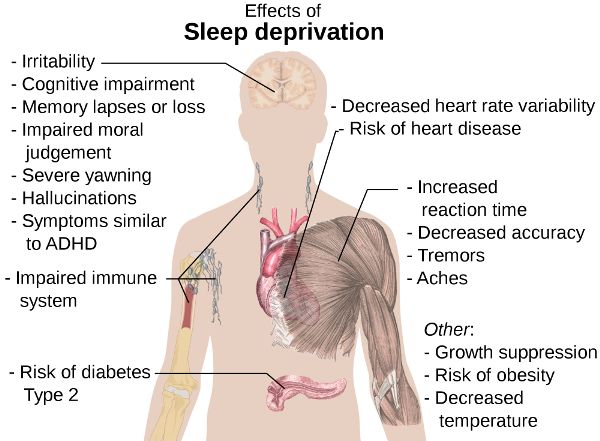 Esquema del cuerpo humano con lista de efectos de la privación del sueño.
