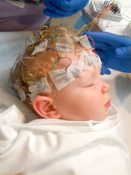 A baby is sleeping with EEG sensors attached to his head.