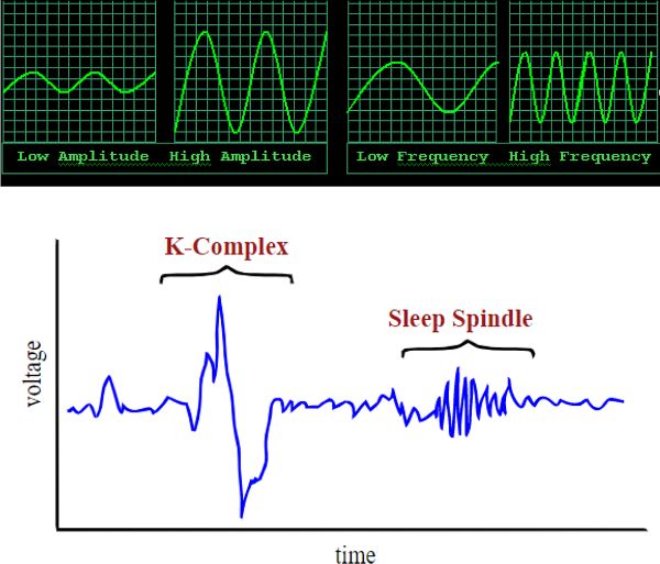 Green and black images showing large and small waves and waves that are coming slowly and quickly. Below that image is a graph with voltage on the y-axis and time on the x-axis. Wavy blue lines show large sweeping vertical lines for K-complex and small wavy lines for sleep spindle.