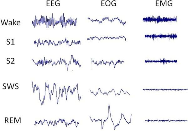 Grabaciones de EEG, EOG y EMG que muestran cambios de voltaje a lo largo del tiempo.