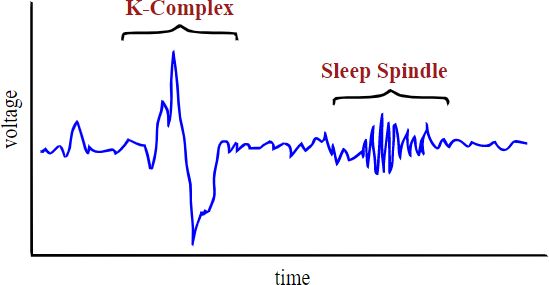 Recording of EEG showing tiny wavy lines for sleep spindle and large sweeping vertical change for k-complex.