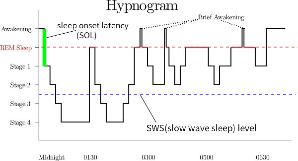 Boxes and lines showing the stages of sleep changing from midnight until 6:30 in the morning with time on the x-axis and sleep stage on the y-axis.