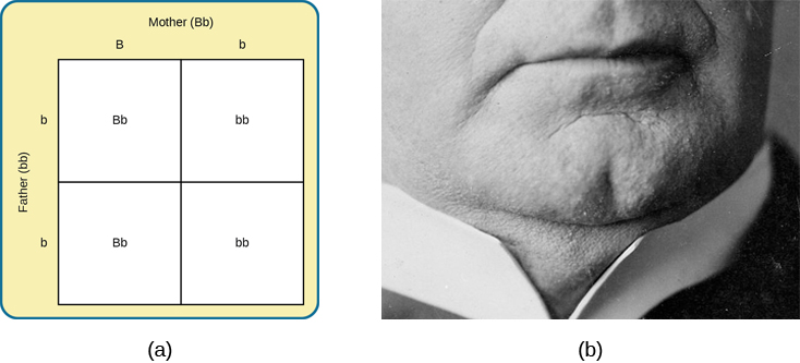 L'image (a) est un carré de Punnett montrant les quatre combinaisons possibles (Bb, bb, Bb, bb) résultant de l'appariement d'un père bb et d'une mère BB. L'image (b) est une photographie rapprochée montrant une fente du menton.