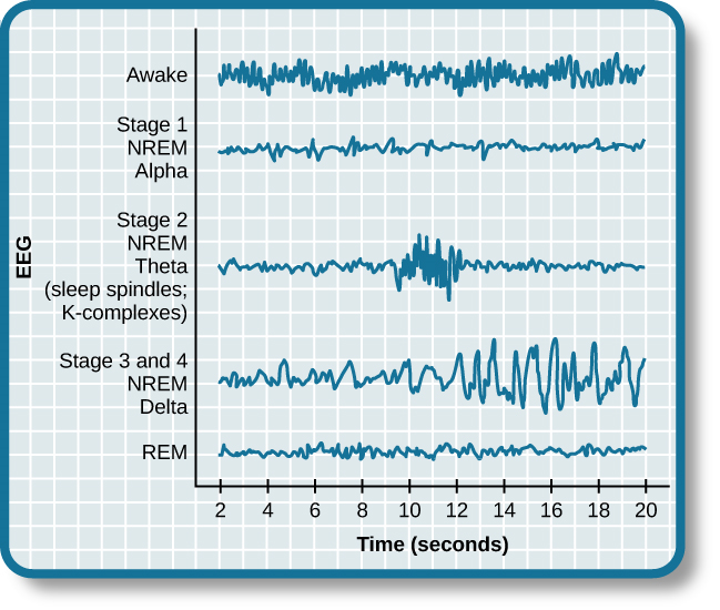 Una gráfica tiene un eje y etiquetado como “EEG” y un eje x etiquetado como “tiempo (segundos). Trazadas a lo largo del eje y y moviéndose hacia arriba están las etapas del sueño. El primero es REM, seguido de las etapas 3 y 4 NREM Delta, Etapa 2 NREM Theta (husillos del sueño; complejos K), Etapa 1 NREM Alpha y Awake. Trazado en el eje x es Tiempo en segundos de 2—20 en intervalos de 2 segundos. Cada etapa del sueño tiene longitudes de onda asociadas de amplitud y frecuencia variables. En relación con los demás, “despierto” tiene una longitud de onda muy cercana y una amplitud media. La etapa 1 se caracteriza por una longitud de onda generalmente uniforme y una amplitud relativamente baja que se duplica y vuelve rápidamente a la normalidad cada 2 segundos. La etapa 2 está compuesta por una longitud de onda similar a la etapa 1. Introduce el complejo K de los segundos 10 al 12, que es una ráfaga corta de amplitud duplicada o triplicada y longitud de onda disminuida. Las etapas 3 y 4 tienen una onda más uniforme con amplitud gradualmente creciente. Finalmente, el sueño REM se parece mucho a la etapa 2 sin el complejo K.