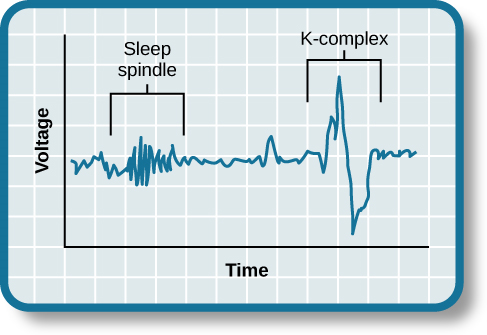 Una gráfica tiene un eje x etiquetado como “tiempo” y un eje y etiquetado como “voltaje”. Una línea ilustra ondas cerebrales, con dos áreas etiquetadas como “huso del sueño” y “complejo k”. El área etiquetada como “huso del sueño” ha disminuido la longitud de onda y la amplitud moderadamente incrementada, mientras que el área etiquetada como “k-complex” tiene una amplitud significativamente alta y una longitud