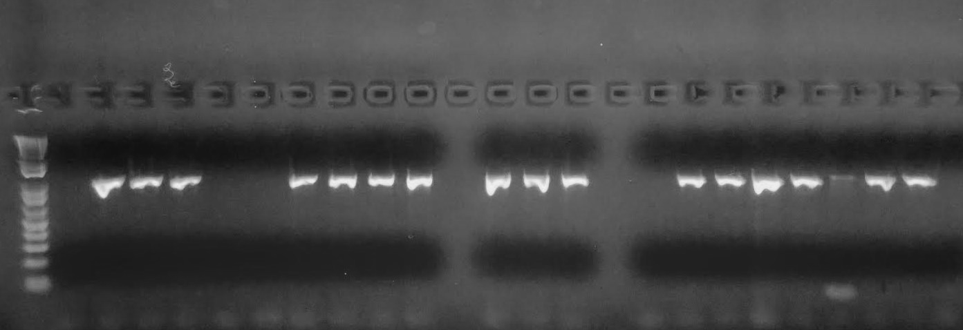 UV light iridescence highlights DNA samples, appearing as many small bands on a gray gel background.