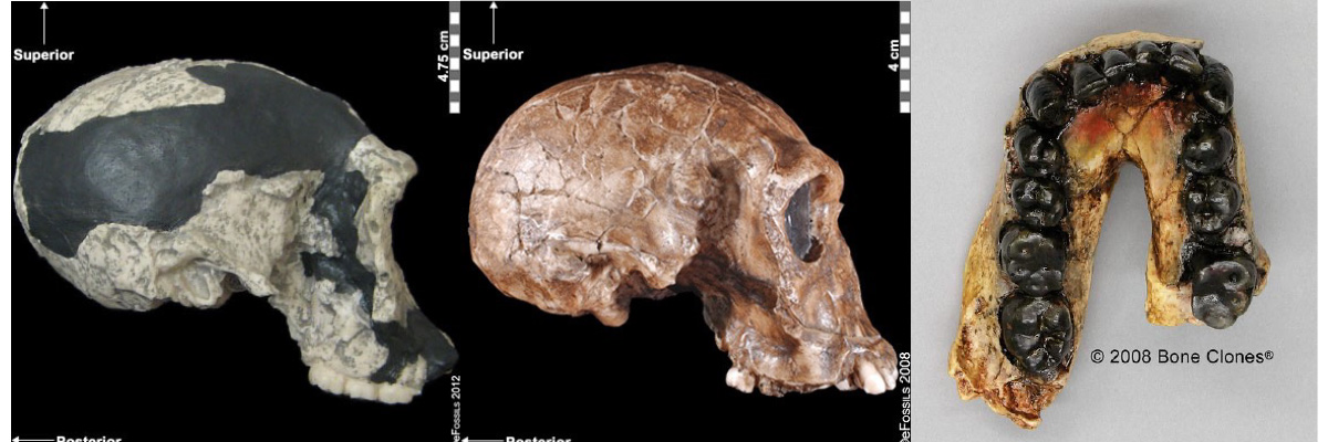 Two lateral right views of skulls and a jaw with blackened teeth.