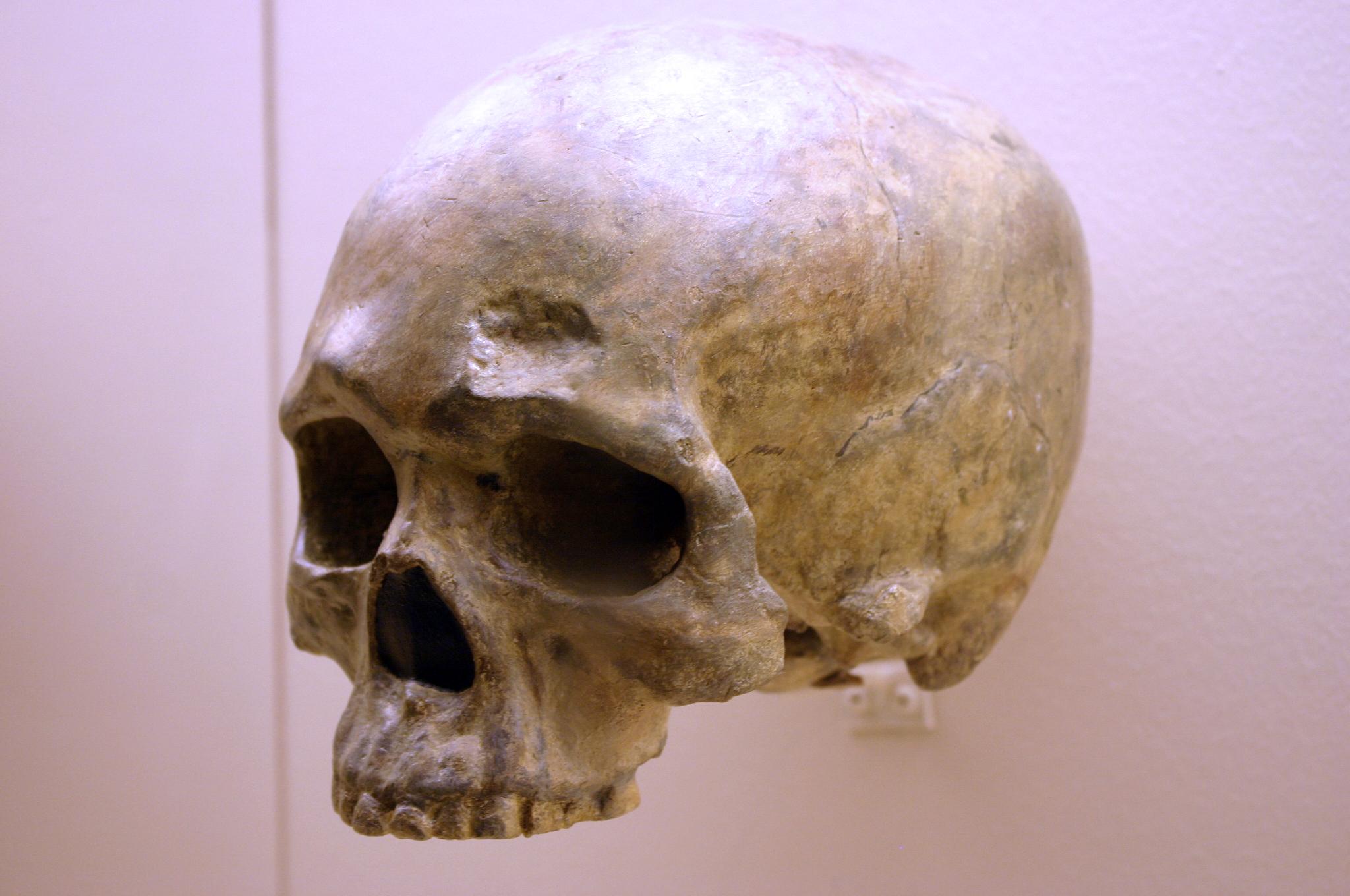A human skull with very slight brow ridges and an extremely globular braincase.