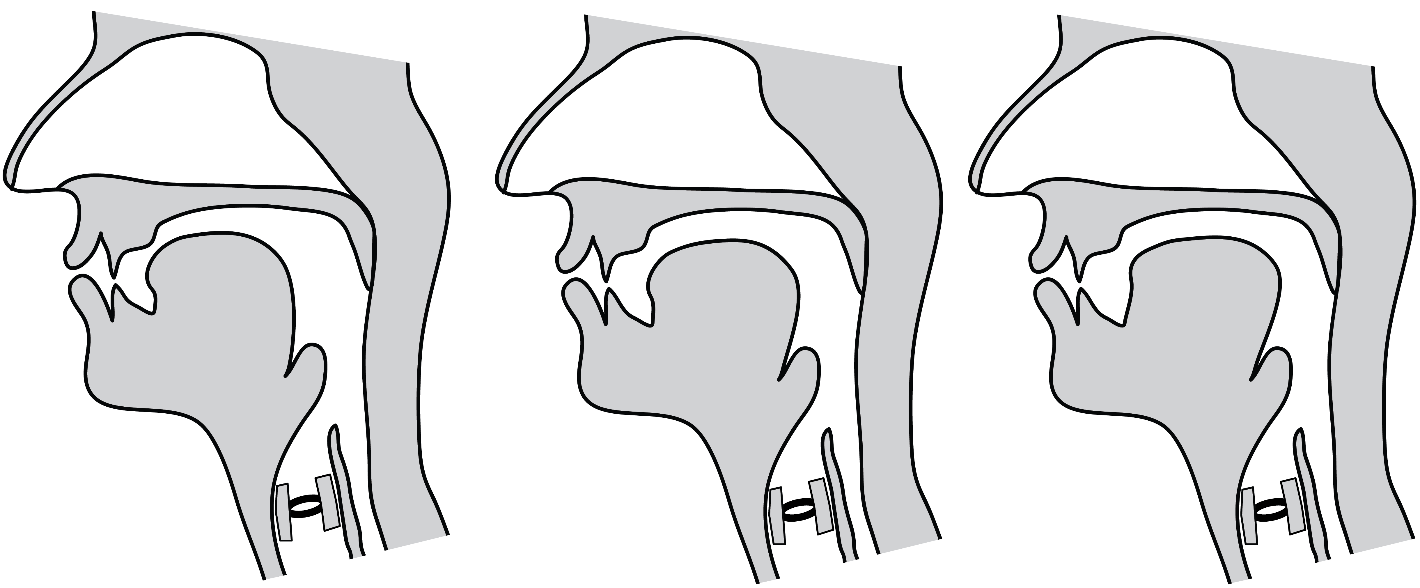 Three midsagittal diagrams, showing a front tongue position, a central tongue position, and a back tongue position.