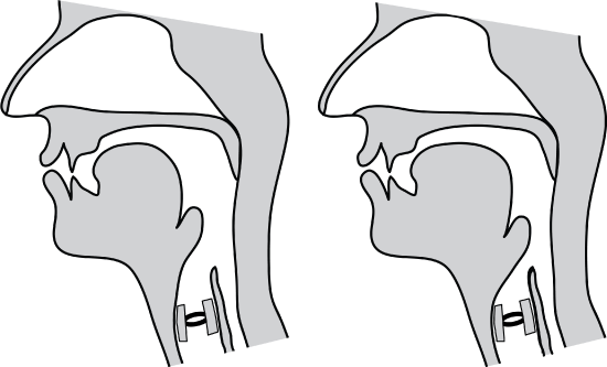 Two midsagittal diagrams, the left with an advanced tongue root and the right with a retracted tongue root.