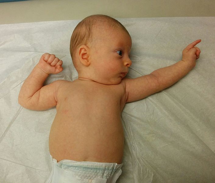 An infant is shown from the waist up, lying on its back with its head facing to its left. The infant's left arm is extended and its right arm is bent.