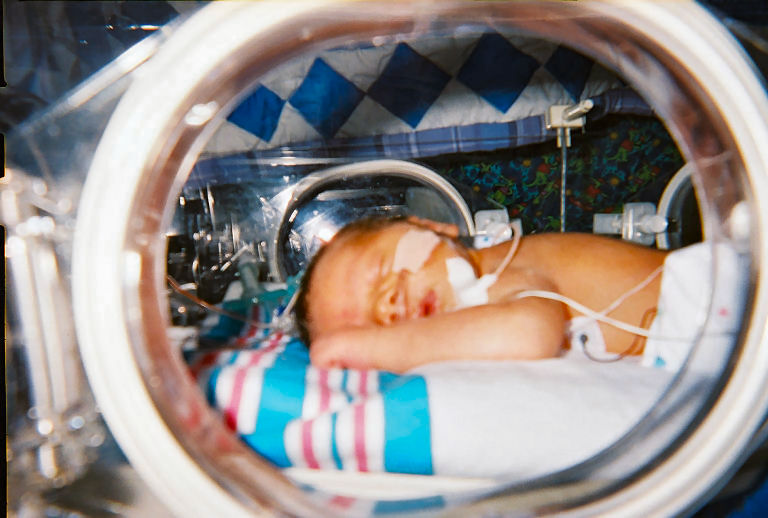 A newborn placed within the clear plastic enclosure of a neonatal care unit is connected to several medical devices.