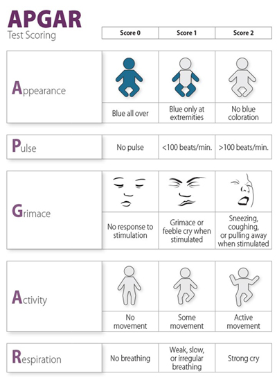 Illustrated APGAR (appearance, pulse, grimace, activity, respiration) Test Scoring chart. The chart visually demonstrates how well a  baby tolerated the birthing process by providing five categories (the rows in  the chart) by which one must rate the newborn on a scale of 0 to 2 (the columns  of the chart), where 0 is the lowest (undesirable) and 2 is the highest (desirable). Row 1: Appearance: Score 0 is 'Blue all over,' showing a  simple illustration of the figure of a baby, all blue; Score 1 is 'Blue only at  extremities,' showing the figure with blue arms and legs and green torso and  head; and Score 2 is 'No blue coloration,' showing the figure, only all purple. Row 2: Pulse: Score 0 is 'No pulse'; Score 1 is 'less than  100 beats per minute'; Score 2 is 'greater than 100 beats per minute.' Row 3: Grimace: Score 0 is 'No response to stimulation,'  showing an illustrated face of a baby who has no facial expression; Score 1 is  'Grimace or feeble cry when stimulated,' showing an illustrated face of a baby  who demonstrates a grimace with a closed mouth; Score 2 is 'Sneezing, coughing,  or pulling away when stimulated,' showing an illustrated face of a baby who has  an open mouth and is the most expressive of the three illustrations. Row 4: Activity: Score 0 is 'No movement,' showing a simple  illustration of the figure of a baby colored blue and demonstrating no  movement; Score 1 is 'Some movement,' showing the figure colored green and  demonstrating movement in one leg; Score 2 is 'Active movement,' showing the  figure colored purple with its arms and legs demonstrating movement. Row 5: Respiration: Score 0 is 'No breathing';  Score 1 is 'Weak, slow, or irregular breathing'; Score 2 is 'Strong cry.'