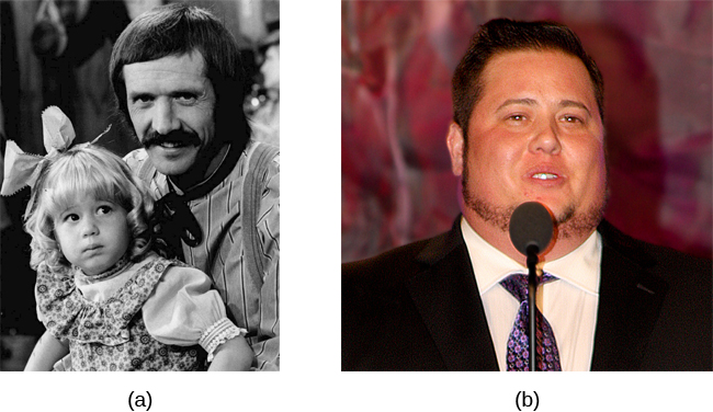Photograph A shows Chaz Bono as a child. Photograph B shows Chaz Bono as an adult.