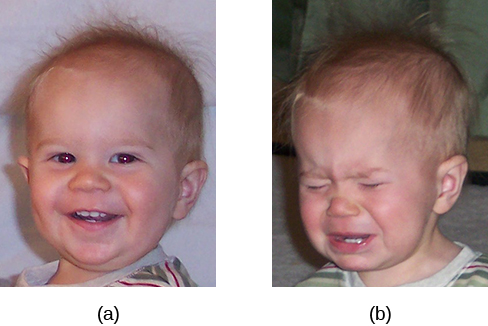 La fotografía A muestra a un niño pequeño riendo. La fotografía B muestra al mismo niño llorando.