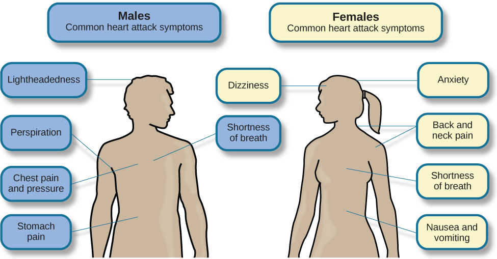 يشير الشكل الذي يوضح الخطوط العريضة لأجسام الذكور والإناث إلى أعراض النوبة القلبية الشائعة لكل جنس. بالنسبة للذكور، تشمل هذه الأعراض الدوار والعرق وألم الصدر والضغط وآلام المعدة وضيق التنفس. بالنسبة للإناث، تشمل هذه الأعراض الدوخة والقلق وآلام الظهر والرقبة وضيق التنفس والغثيان والقيء.