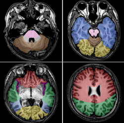 mindtouch.page#thumbnail