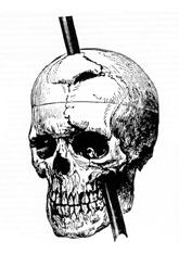 Phineas_gage_-_1868_skull_diagram.jpg