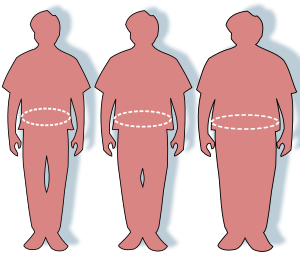 300px-Obesity-waist_circumference.svg.png