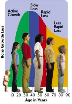 Bone growth/loss as one advances in age (infant – 90), from active growth, slow loss, rapid loss, to less rapid loss.