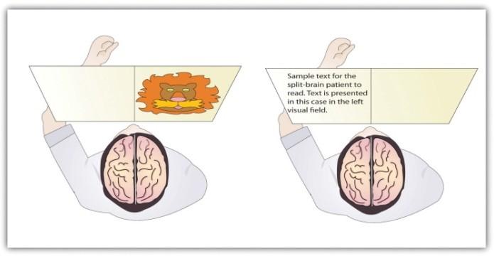 En la muestra de la izquierda, el paciente de cerebro dividido no pudo elegir qué imagen se había presentado porque el hemisferio izquierdo no puede procesar información visual. En la muestra de la derecha el paciente no pudo leer el pasaje porque el hemisferio derecho del cerebro no puede procesar el lenguaje.