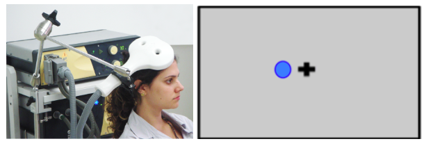 Image of a person with a TMS wand held over the head. To the right of that, there is a cross and a white circle with a blue outline. This represents how that circle would temporarily disappear for someone during the TMS stimulation.