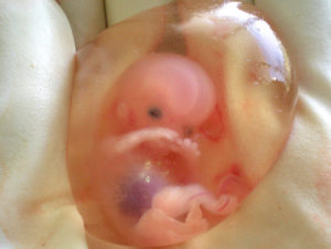Fetus at 10 weeks of development.
