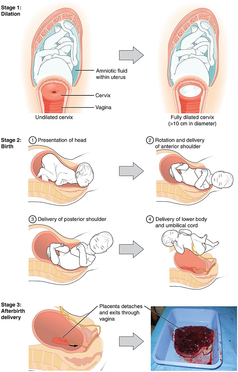 Diagram showing the three stages of childbirth: dilation, birth, and the afterbirth delivery. Stage 1: Dilation. The amniotic fluid is within the uterus, the cervix goes from undiluted to fully dilated at over 10 centimeters in diameter. Stage 2: Birth. First, the presentation of the head. Then, the rotation and delivery of anterior shoulder. Then the delivery of posterior shoulder. Then the delivery of the lower body and umbilical cord. Stage 3: Afterbirth delivery. The placenta detaches and exists through the vagina.