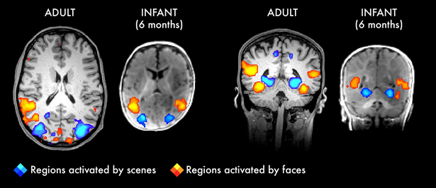 Brain MRIs that show similar regions activated by adult brains and infant brains while looking at either scenes or faces.