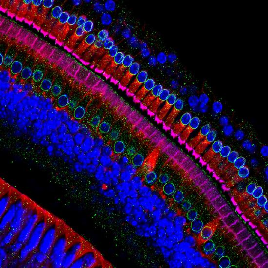 Human hair cells in the ear