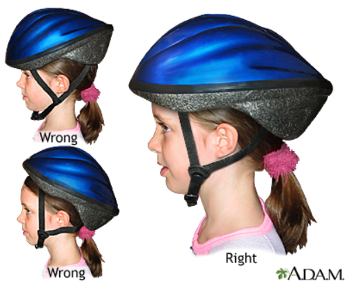 diagrama que muestra el ajuste correcto y incorrecto del casco