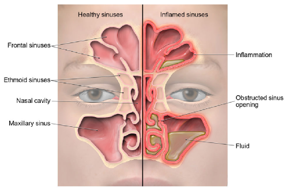 diagram of sinuses
