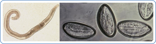 Lombriz intestinal de Enterobius vermicularis