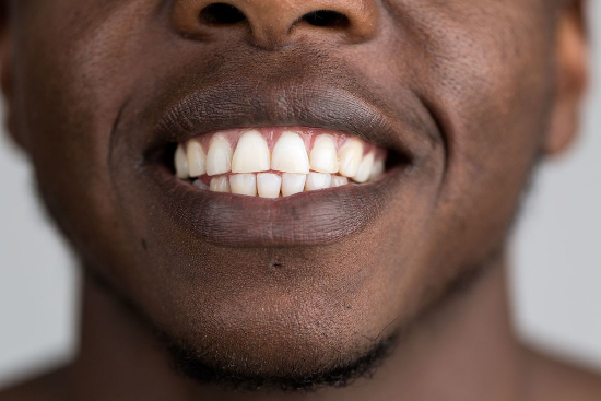 Image of adult human teeth.