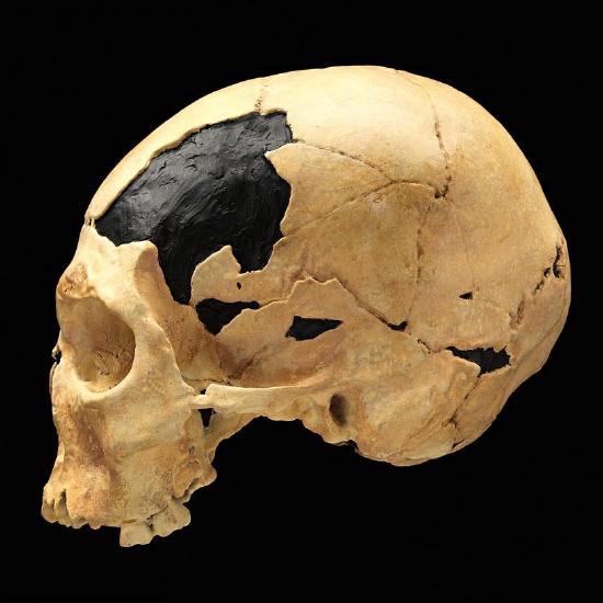 This side view of the Oase 2 cranium shows the reduced brow ridges but also occipital bunning that is a sign that modern Homo sapiens interbred with Neanderthals.