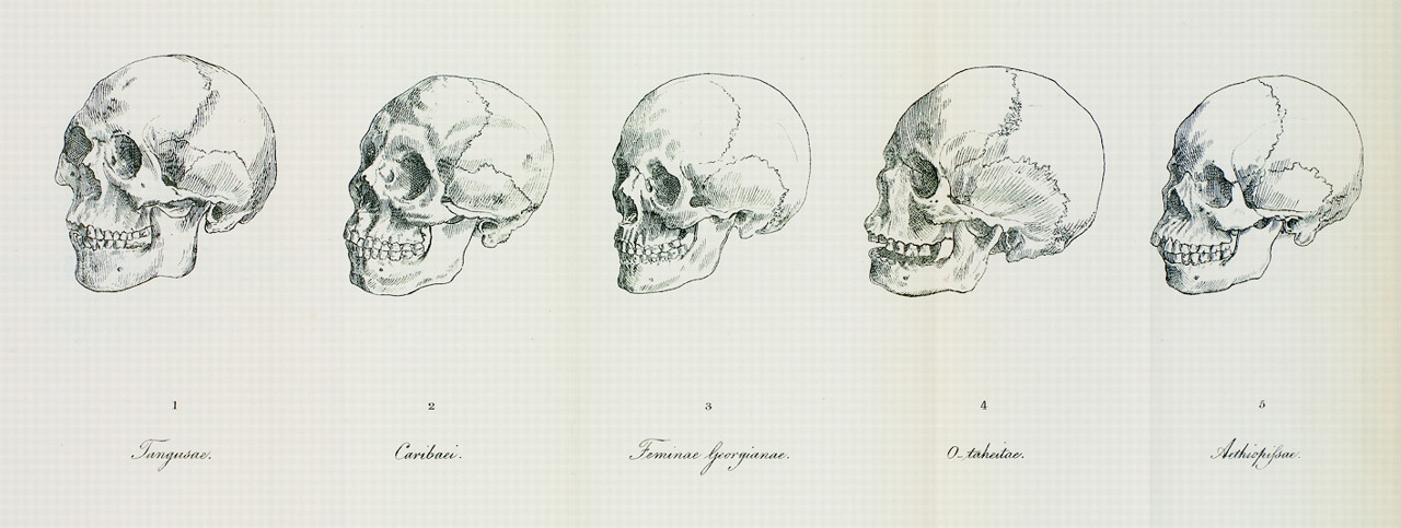 Five skull drawings representing specimens for Blumenbach’s “Mongolian,” “American,” “Caucasian,” “Malayan,” and “Aethiopian” races.