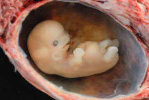 Embryo at an early stage of development, showing arms and legs and facial features beginning to form.