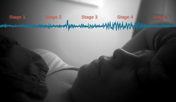 Uma fotografia mostra uma pessoa dormindo. Sobreposta na parte superior da imagem está uma linha representando a atividade das ondas cerebrais nos cinco estágios do sono. Acima da linha, da esquerda para a direita, ele lê o estágio 1, o estágio 2, o estágio 3, o estágio 4 e o estágio 5. A amplitude da onda é maior no final do estágio 2 e próximo ao final do estágio 3 até o estágio 4. O comprimento de onda é maior desde o estágio final 2 até o estágio 4.