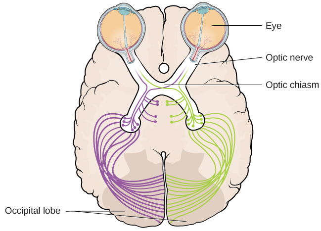 يُظهر رسم توضيحي موقع الفص القذالي والصدع البصري والعصب البصري والعيون فيما يتعلق بموضعها في الدماغ والرأس.