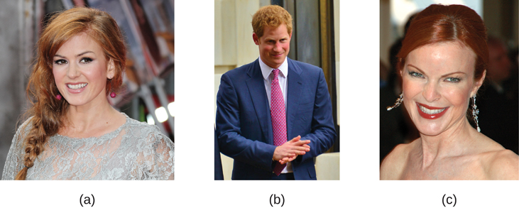 A fotografia A mostra Isla Fischer. A fotografia B mostra o Príncipe Harry. A fotografia C mostra Marcia Cross.