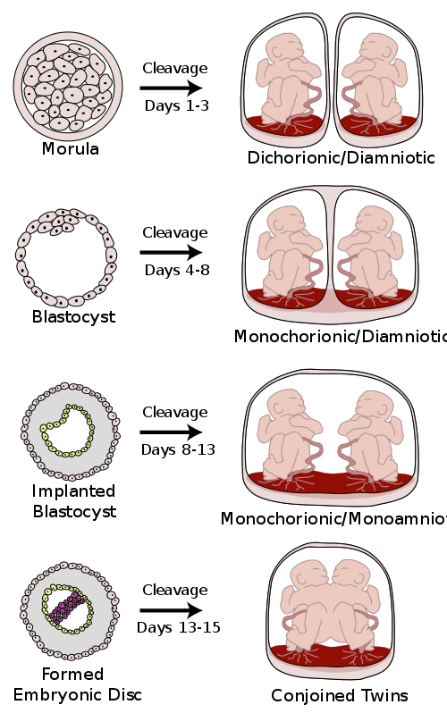 Diagram showing ways that twins are formed.