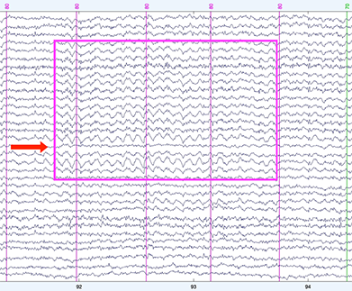 7: Inspecting the EEG and Interpolating Bad Channels