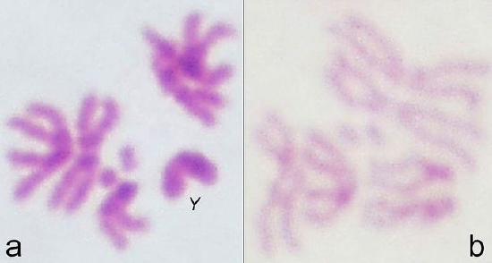 Side by side microphotographs of human chromosomes with photo on the left including an image of a Y chromosome.