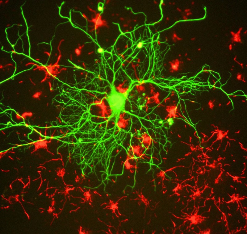 Micrografía de una neurona multipolar con ramificación dendrítica extensa, mostrando muchas neuronas similares en el fondo.