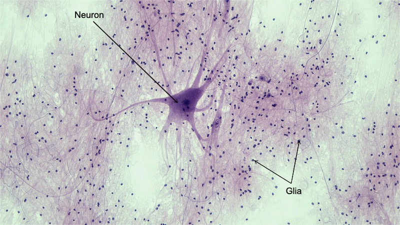 Fotomicrografía de un cuerpo celular neuronal grande con múltiples procesos rodeados por muchas células gliales pequeñas