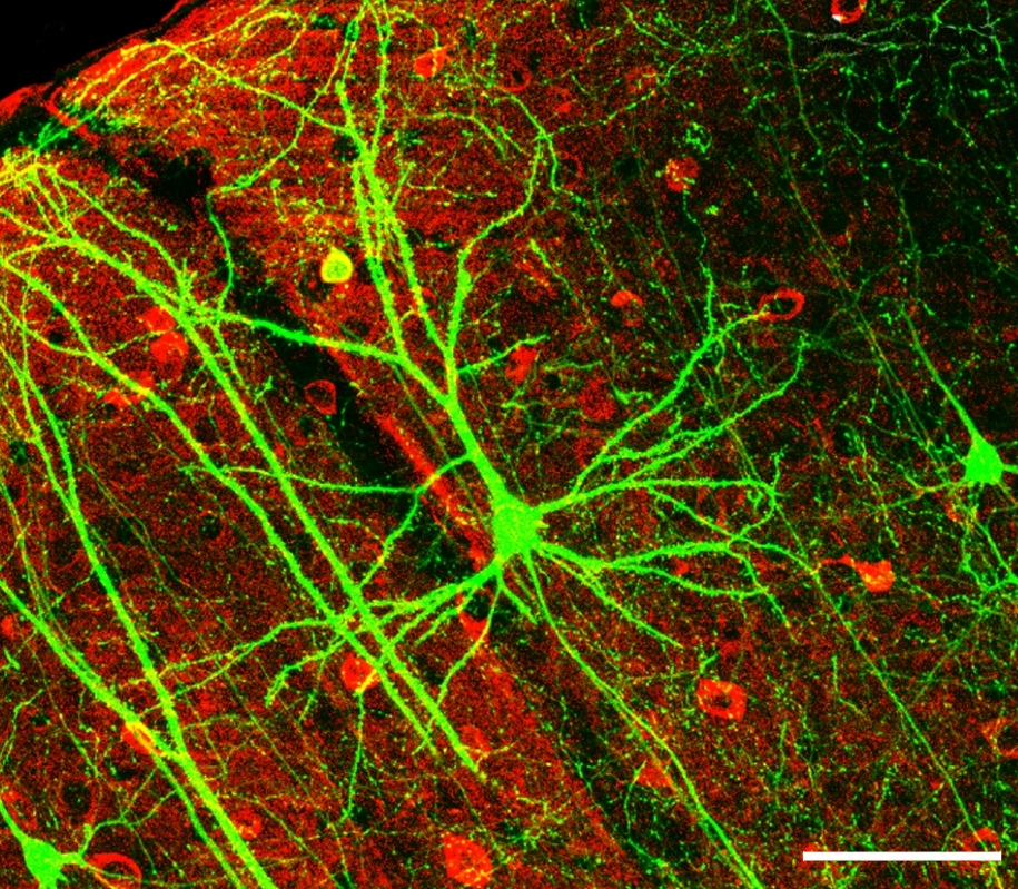 Neuronas de la corteza visual teñidas fluorescentemente